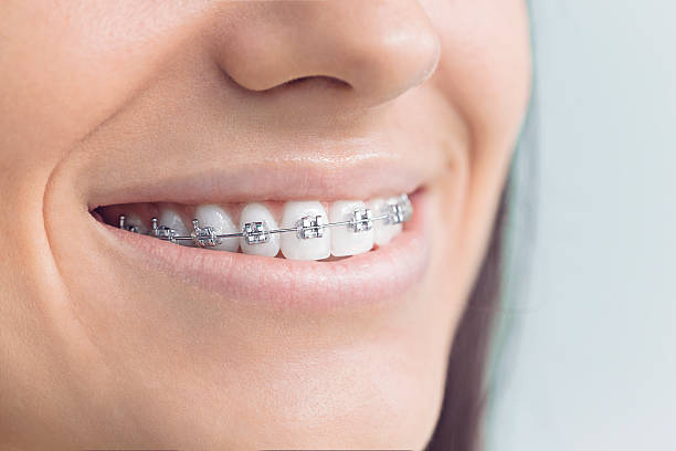 Why Choose Us for Your Dental Needs in Millersburg, OH